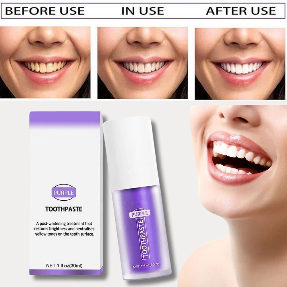 Purple Toothpaste for Teeth Whitening - Tooth Stain Removal, Purple Teeth Whitener, Foam Formula